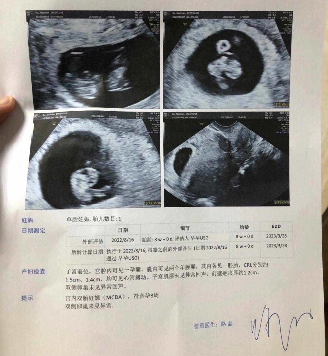 爱体育官网-五万分之一的概率！麦迪逊女友又怀双胞胎已育有3娃